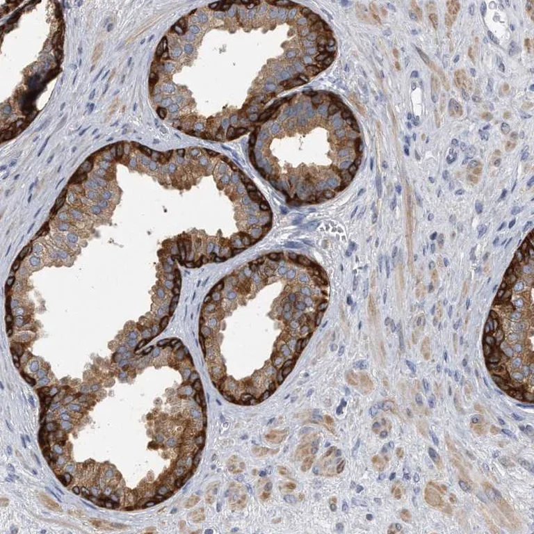 Immunohistochemistry (Formalin/PFA-fixed paraffin-embedded sections) - Anti-GPBB antibody (AB251810)