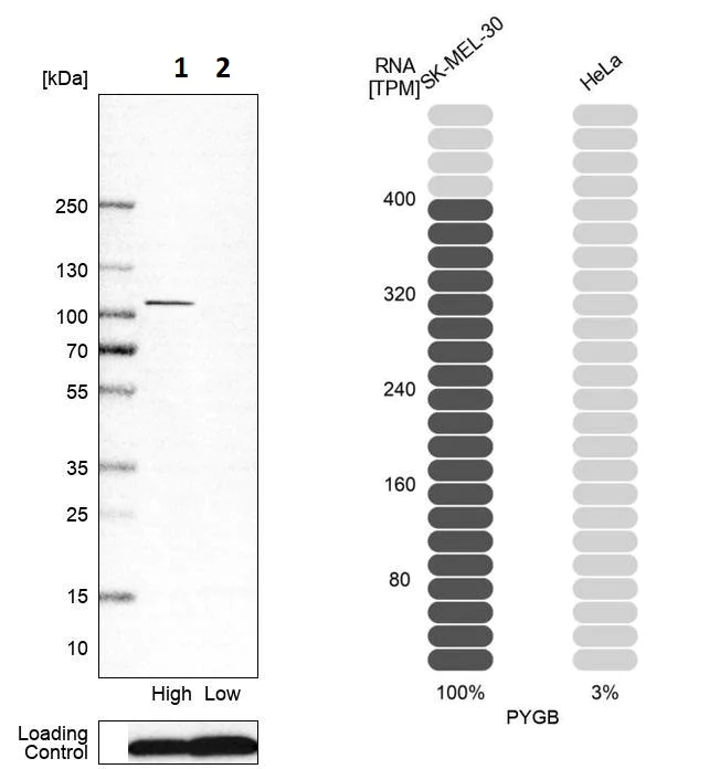 Western blot - Anti-GPBB antibody (AB251810)