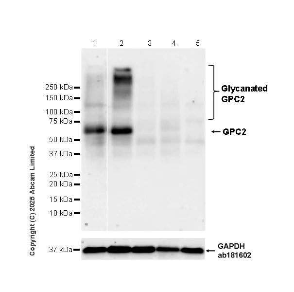 Western blot - Anti-GPC2 antibody [EPR30350-587] (AB324954)
