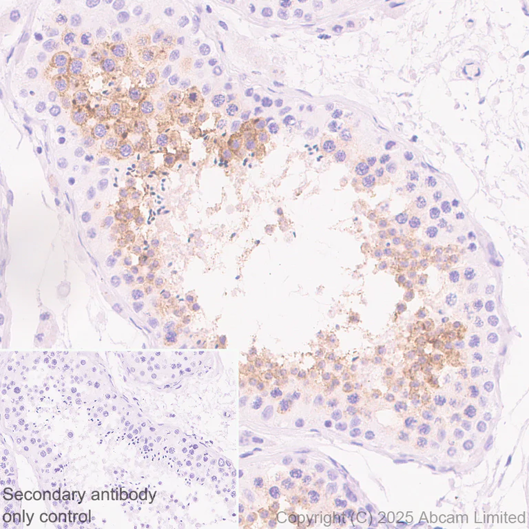 Immunohistochemistry (Formalin/PFA-fixed paraffin-embedded sections) - Anti-GPC2 antibody [EPR30350-627] (AB324378)