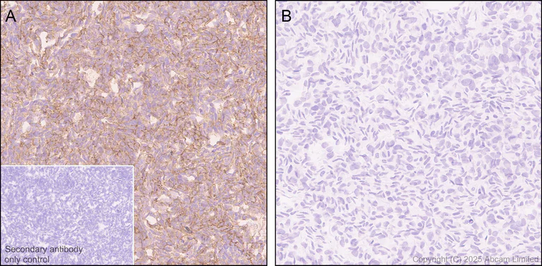 Immunohistochemistry (Formalin/PFA-fixed paraffin-embedded sections) - Anti-GPC2 antibody [EPR30350-627] (AB324378)