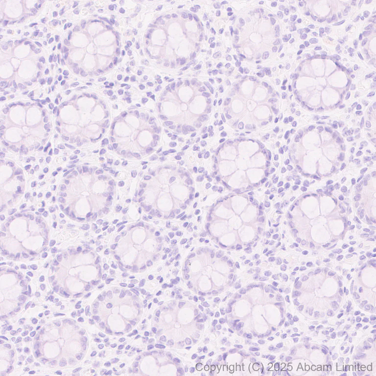 Immunohistochemistry (Formalin/PFA-fixed paraffin-embedded sections) - Anti-GPC2 antibody [EPR30350-627] - BSA and Azide free (AB326056)