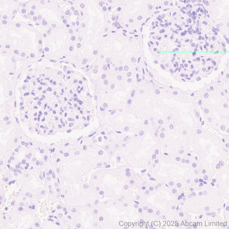 Immunohistochemistry (Formalin/PFA-fixed paraffin-embedded sections) - Anti-GPC2 antibody [EPR30350-627] - BSA and Azide free (AB326056)
