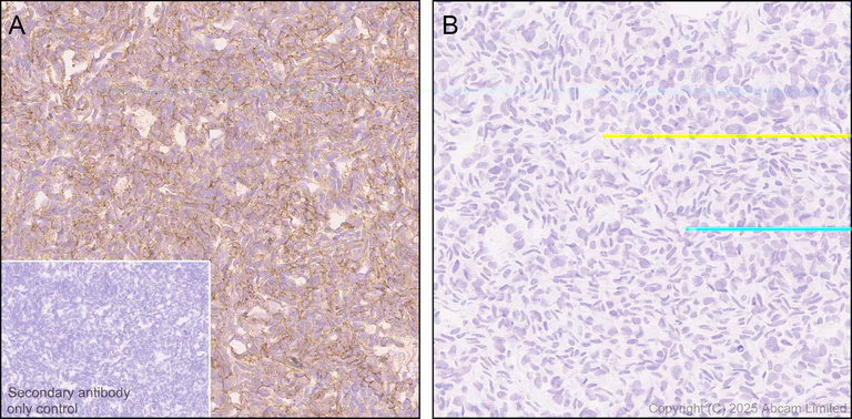 Immunohistochemistry (Formalin/PFA-fixed paraffin-embedded sections) - Anti-GPC2 antibody [EPR30350-627] - BSA and Azide free (AB326056)