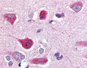 Immunohistochemistry (Formalin/PFA-fixed paraffin-embedded sections) - Anti-GPCR C5L2 antibody (AB116709)