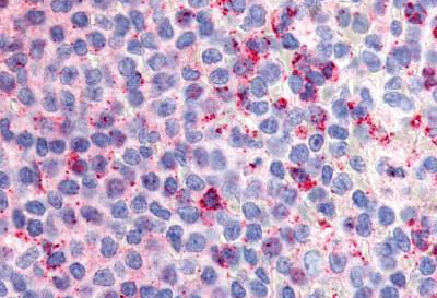 Immunohistochemistry (Formalin/PFA-fixed paraffin-embedded sections) - Anti-GPCR G2A antibody - Extracellular domain (AB150509)