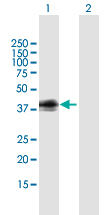 Western blot - Anti-GPCR GPR1 antibody (AB169331)