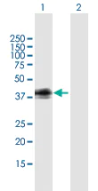Western blot - Anti-GPCR GPR1 antibody (AB169331)