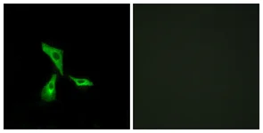 Immunocytochemistry/ Immunofluorescence - Anti-GPCR GPR101 antibody (AB131117)