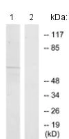 Western blot - Anti-GPCR GPR101 antibody (AB131117)