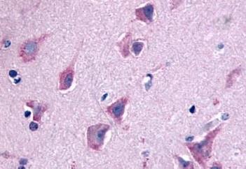 Immunohistochemistry (Formalin/PFA-fixed paraffin-embedded sections) - Anti-GPCR GPR103 antibody - N-terminal (AB188976), expandable thumbnail