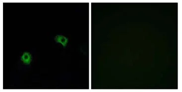 Immunocytochemistry/ Immunofluorescence - Anti-GPCR GPR116 antibody (AB111169)
