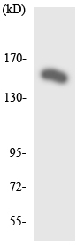 Western blot - Anti-GPCR GPR116 antibody (AB136262), expandable thumbnail