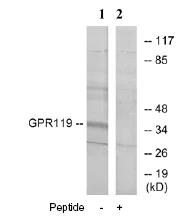 Western blot - Anti-GPCR GPR119 antibody (AB75312)