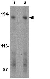 Western blot - Anti-GPCR GPR124 antibody (AB67279)