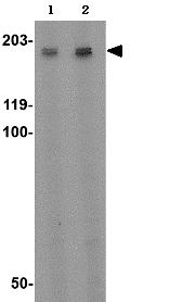 Western blot - Anti-GPCR GPR124 antibody (AB67280)