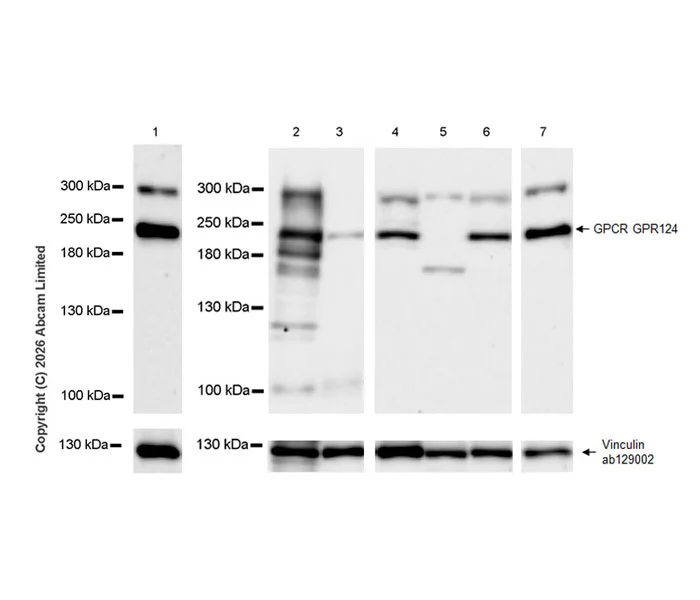 Western blot - Anti-GPCR GPR124 antibody [EPR28788-180] (AB325183)