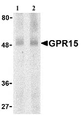 Western blot - Anti-GPCR GPR15 antibody (AB8104)