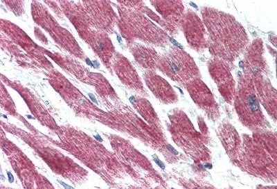 Immunohistochemistry (Formalin/PFA-fixed paraffin-embedded sections) - Anti-GPCR GPR15 antibody - Extracellular domain (AB188938)