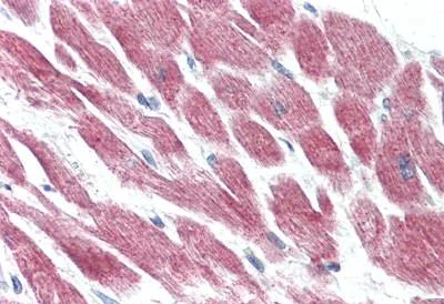 Immunohistochemistry (Formalin/PFA-fixed paraffin-embedded sections) - Anti-GPCR GPR15 antibody - Extracellular domain (AB188938)