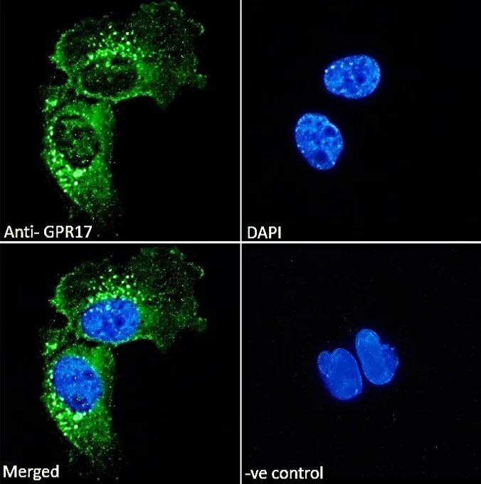 Immunocytochemistry - Anti-GPCR GPR17 antibody (AB106781)