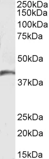 Western blot - Anti-GPCR GPR17 antibody (AB106781)