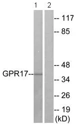 Western blot - Anti-GPCR GPR17 antibody (AB75553)
