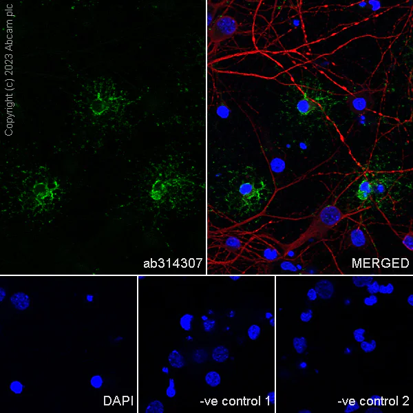 Immunocytochemistry/ Immunofluorescence - Anti-GPCR GPR17 antibody [EPR26422-118] (AB314307)