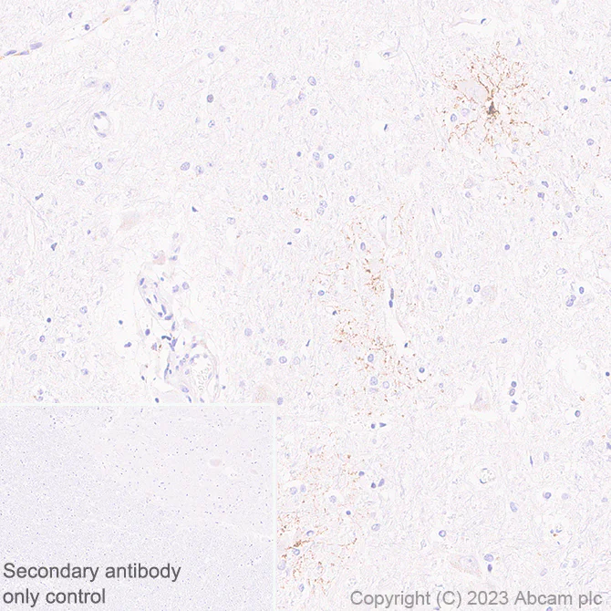 Immunohistochemistry (Formalin/PFA-fixed paraffin-embedded sections) - Anti-GPCR GPR17 antibody [EPR26422-118] (AB314307)