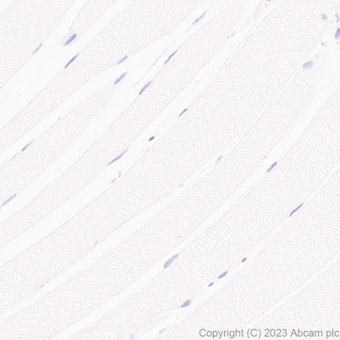 Immunohistochemistry (Formalin/PFA-fixed paraffin-embedded sections) - Anti-GPCR GPR17 antibody [EPR26422-118] (AB314307)