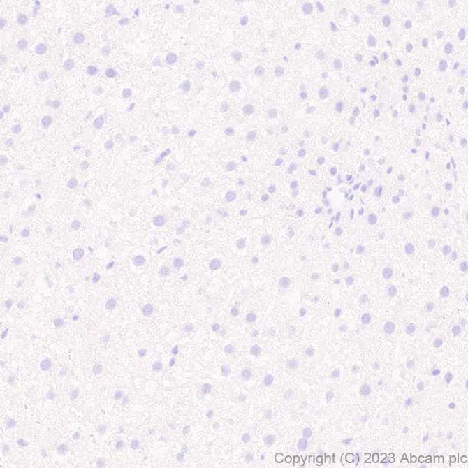 Immunohistochemistry (Formalin/PFA-fixed paraffin-embedded sections) - Anti-GPCR GPR17 antibody [EPR26422-118] (AB314307)