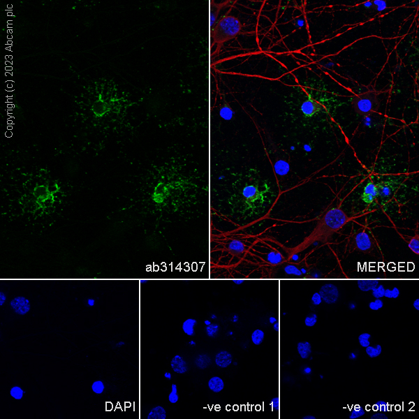 Immunocytochemistry/ Immunofluorescence - Anti-GPCR GPR17 antibody [EPR26422-118] - BSA and Azide free (ab314308), expandable thumbnail