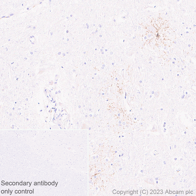 Immunohistochemistry (Formalin/PFA-fixed paraffin-embedded sections) - Anti-GPCR GPR17 antibody [EPR26422-118] - BSA and Azide free (ab314308), expandable thumbnail