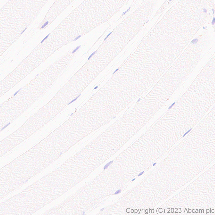 Immunohistochemistry (Formalin/PFA-fixed paraffin-embedded sections) - Anti-GPCR GPR17 antibody [EPR26422-118] - BSA and Azide free (ab314308), expandable thumbnail