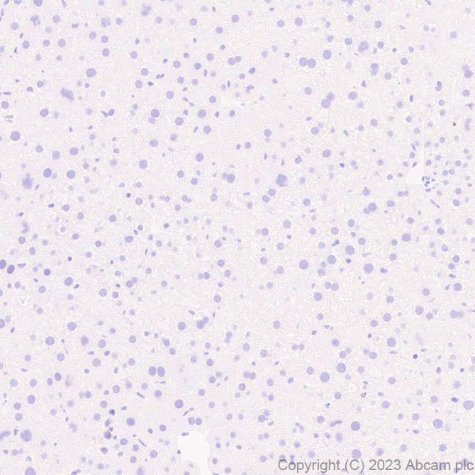 Immunohistochemistry (Formalin/PFA-fixed paraffin-embedded sections) - Anti-GPCR GPR17 antibody [EPR26422-118] - BSA and Azide free (ab314308), expandable thumbnail