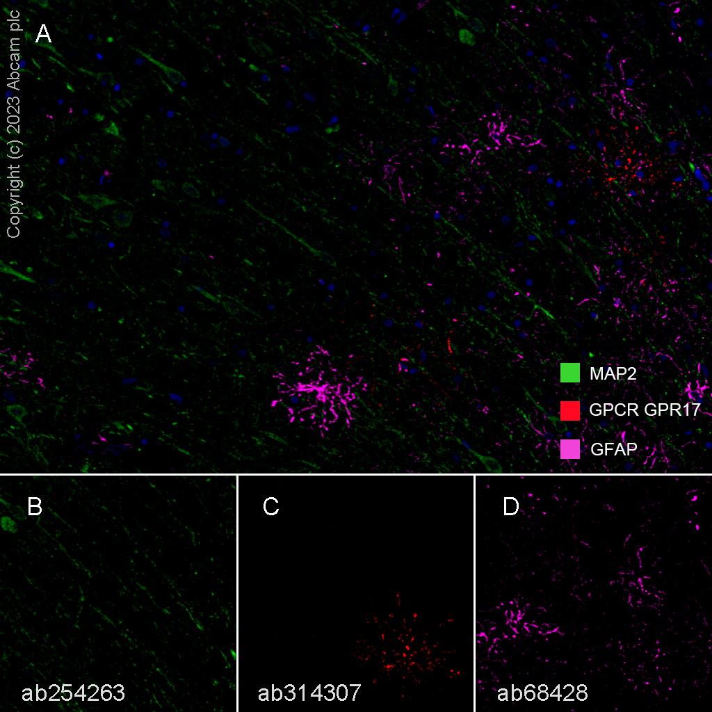 Multiplex immunohistochemistry - Anti-GPCR GPR17 antibody [EPR26422-118] - BSA and Azide free (ab314308), expandable thumbnail