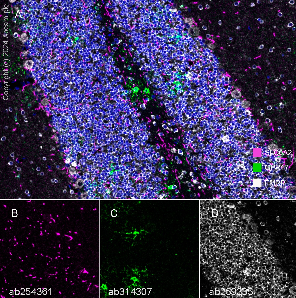 Multiplex immunohistochemistry - Anti-GPCR GPR17 antibody [EPR26422-118] - BSA and Azide free (ab314308), expandable thumbnail