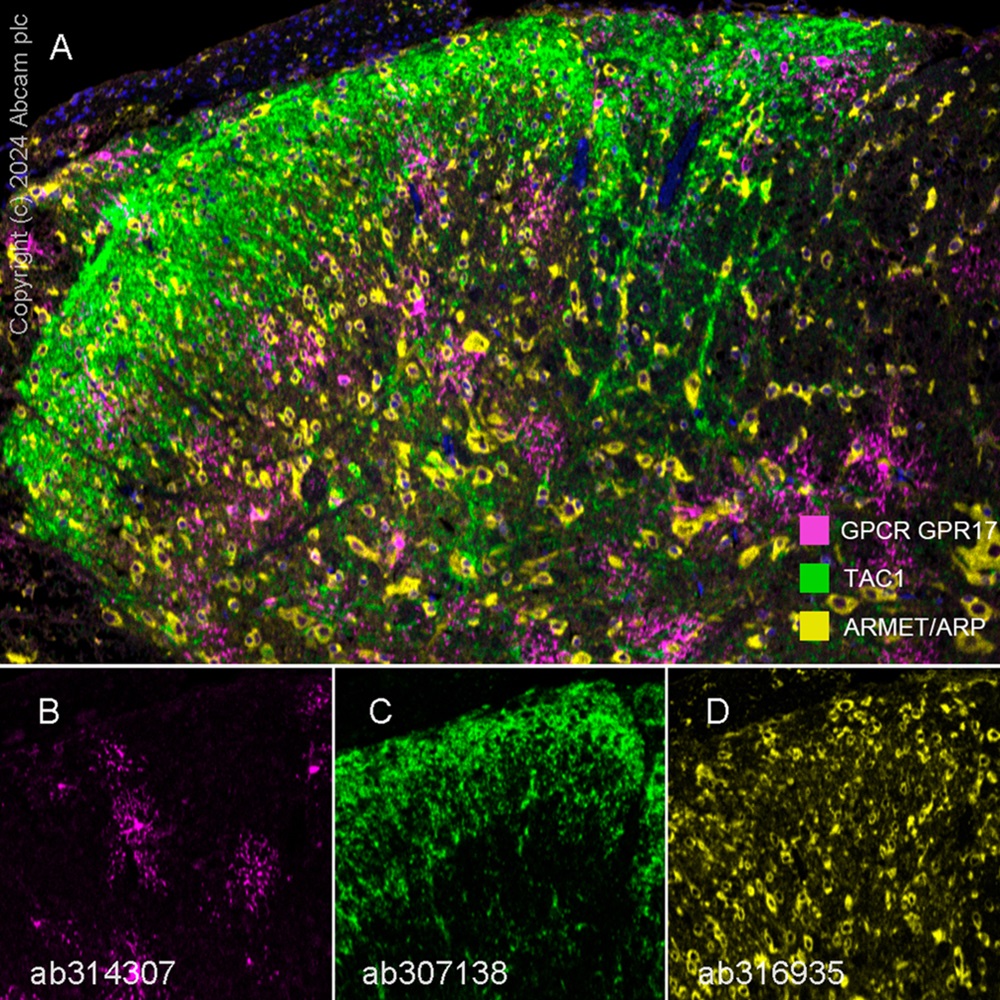Multiplex immunohistochemistry - Anti-GPCR GPR17 antibody [EPR26422-118] - BSA and Azide free (AB314308), expandable thumbnail