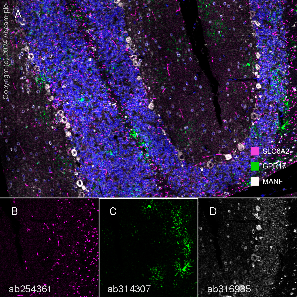 Multiplex immunohistochemistry - Anti-GPCR GPR17 antibody [EPR26422-118] - BSA and Azide free (ab314308), expandable thumbnail