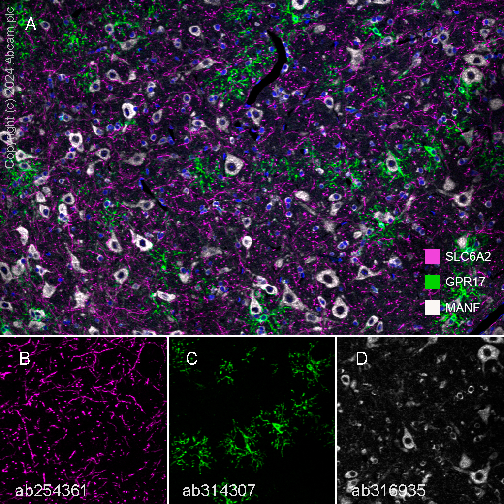 Multiplex immunohistochemistry - Anti-GPCR GPR17 antibody [EPR26422-118] - BSA and Azide free (ab314308), expandable thumbnail