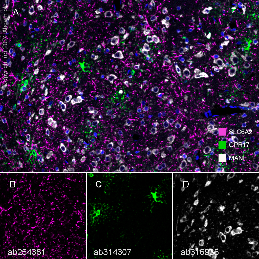 Multiplex immunohistochemistry - Anti-GPCR GPR17 antibody [EPR26422-118] - BSA and Azide free (AB314308), expandable thumbnail