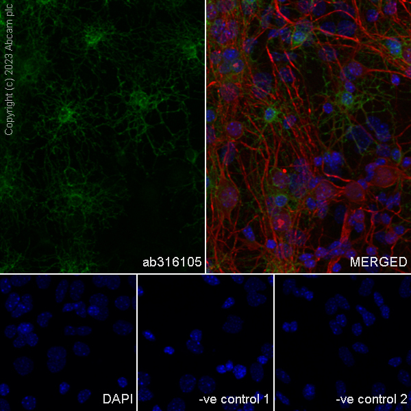 Immunocytochemistry/ Immunofluorescence - Anti-GPCR GPR17 antibody [EPR26423-34] (ab316105), expandable thumbnail