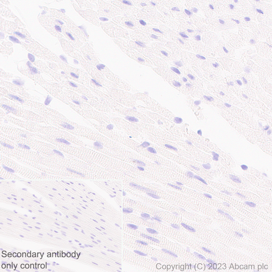 Immunohistochemistry (Formalin/PFA-fixed paraffin-embedded sections) - Anti-GPCR GPR17 antibody [EPR26423-34] (ab316105), expandable thumbnail