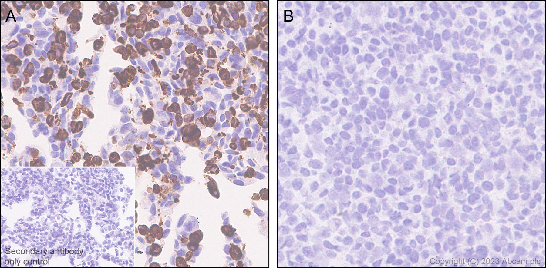 Immunohistochemistry (Formalin/PFA-fixed paraffin-embedded sections) - Anti-GPCR GPR17 antibody [EPR26423-34] (ab316105), expandable thumbnail