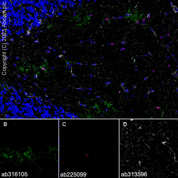 Immunohistochemistry (Frozen sections) - Anti-GPCR GPR17 antibody [EPR26423-34] (ab316105), expandable thumbnail