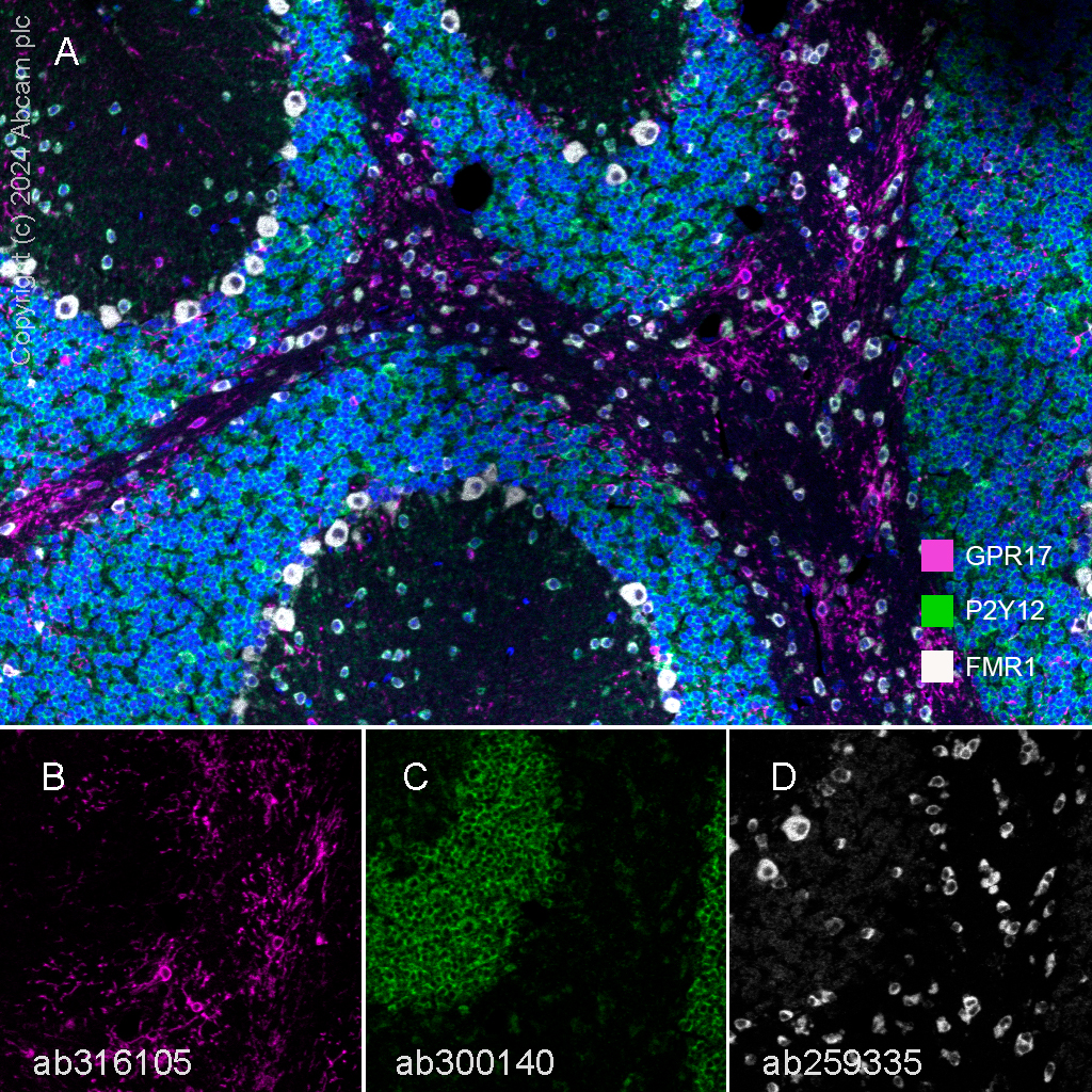 Multiplex immunohistochemistry - Anti-GPCR GPR17 antibody [EPR26423-34] (ab316105), expandable thumbnail
