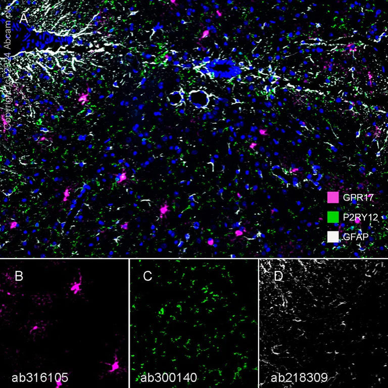 Multiplex immunohistochemistry - Anti-GPCR GPR17 antibody [EPR26423-34] (AB316105)