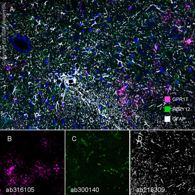 Multiplex immunohistochemistry - Anti-GPCR GPR17 antibody [EPR26423-34] (AB316105)