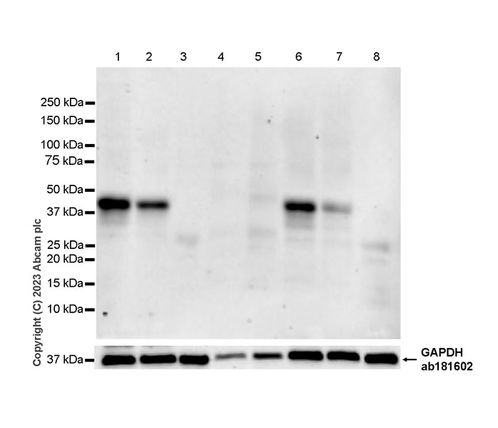 Western blot - Anti-GPCR GPR17 antibody [EPR26423-34] (ab316105), expandable thumbnail