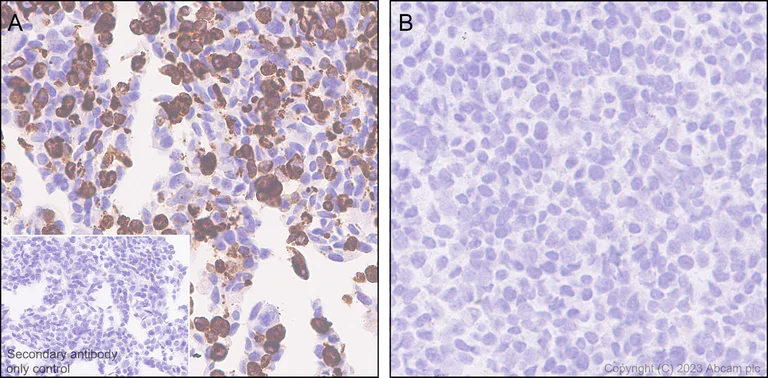 Immunohistochemistry (Formalin/PFA-fixed paraffin-embedded sections) - Anti-GPCR GPR17 antibody [EPR26423-34] - BSA and Azide free (AB316106)